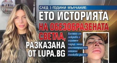 СЛЕД 3 ГОДИНИ МЪЛЧАНИЕ: Ето историята на обезобразената Светла, разказана от Lupa.bg