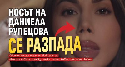Носът на Даниела Рупецова се разпада