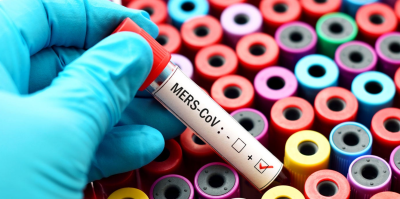 Световната здравна организация СЗО издаде строго предупреждение във връзка с