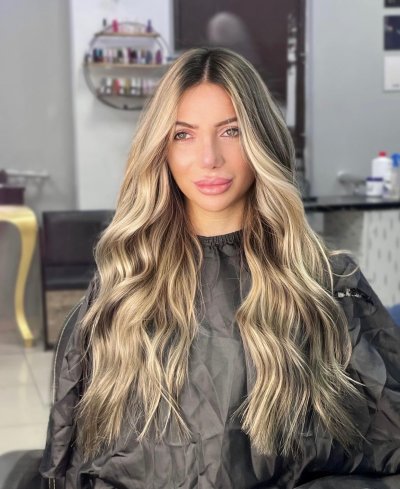 СЛЕД 3 ГОДИНИ МЪЛЧАНИЕ: Ето историята на обезобразената Светла, разказана от Lupa.bg