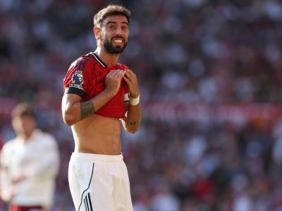 Бруно Фернандеш пропуска поне още един мач