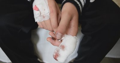 Пиратка откъсна пръстите на 14-годишен 