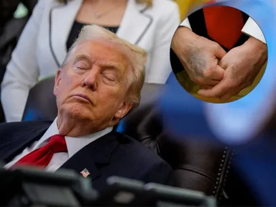 Белият дом прикрива информацията че Доналд Тръмп е преживял инсулт