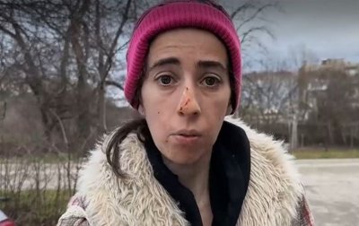 Агресивно куче наръфа жена в Казанлък