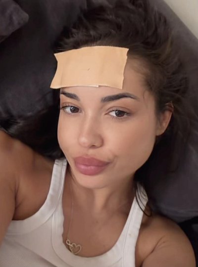 Бонбонова си разби главата