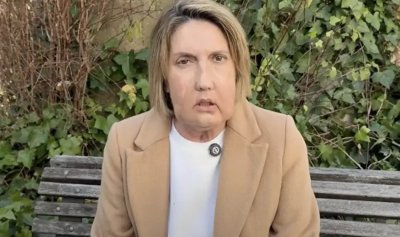 За първи път: Жена дари лицето си преди евтаназията, трансплантираха го на обезобразена испанка