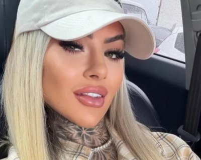 Инфлуенсърка почина след пластична операция