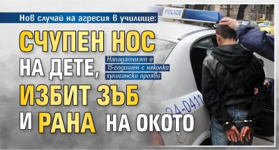 Нов случай на агресия в училище: Счупен нос на дете, избит зъб и рана на окото 