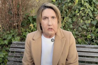 РЕВОЛЮЦИОННО: Трансплантираха лице от евтаназиран донор