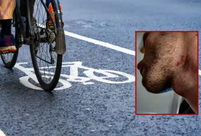 3 години чака справедливост: Бивш полицай пребил велосипедист с палка