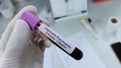 Жена от Бургас почина от легионерска болест