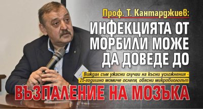 Проф. Т. Кантарджиев: Инфекцията от морбили може да доведе до възпаление на мозъка