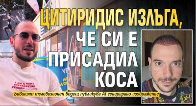 Цитиридис излъга, че си е присадил коса