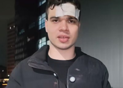 ВИДЕО: Пребитият Пело Кръстев: Имам 7 шева на главата, откраднаха ми телефона