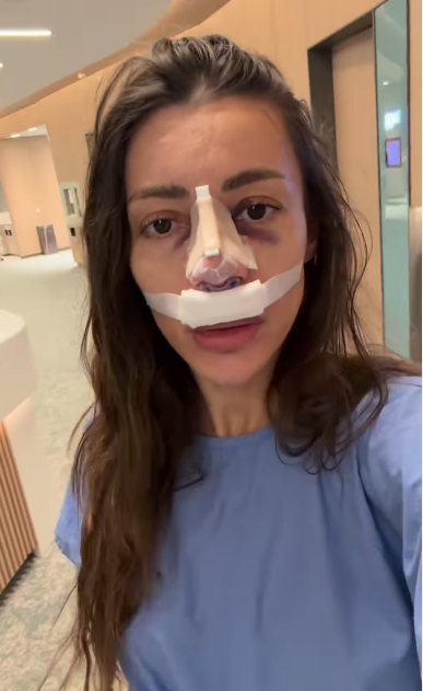 Ето го новия нос на Мая Пауновска