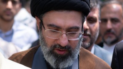 Аятолах Хаменей се подлага на пластична операция