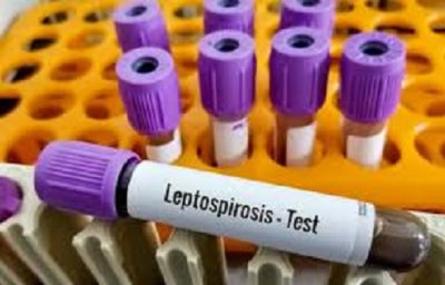 ВНИМАНИЕ, ТУРИСТИ: Трима пипнаха смъртоносна бактерия в Гърция, един умря