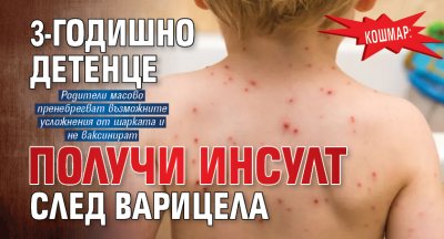 КОШМАР: 3-годишно детенце получи инсулт след варицела