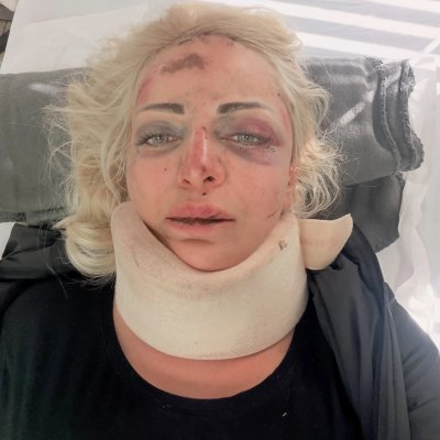 Гадже пребило Жанета Осипова (Снимка 18+)