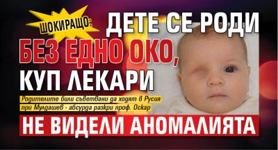 ШОКИРАЩО: Дете се роди без едно око, куп лекари не видели аномалията