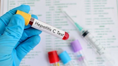 Националната референтна лаборатория по вирусни хепатити към Националния център по