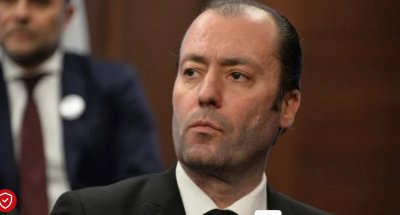 Нойзи смени визията: Не съм присадил коса, не съм толкова суетен 