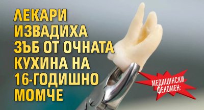 Медицински феномен: Лекари извадиха зъб от очната кухина на 16-годишно момче