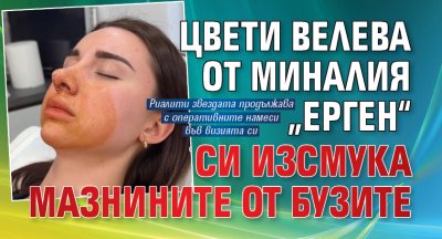 Цвети Велева от миналия &bdquo;Ерген&ldquo; си изсмука мазнините от бузите