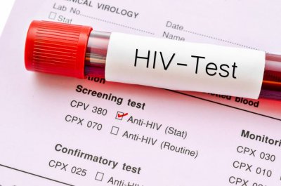 Световна сензация: Май идва край на СПИН-а