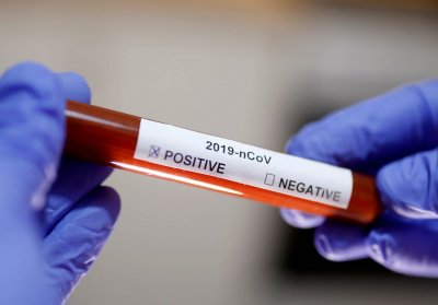 1014 са заразени с коронавирус в Босна и Херцеговина