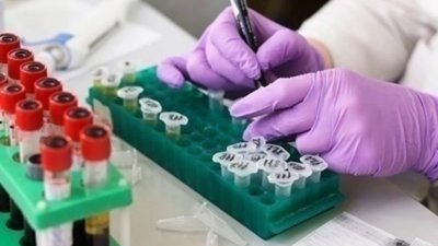 В Ивайловград започна широк скрининг за коронавирус
