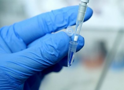 Двамата пациенти с COVID-19 с прелята кръвна плазма са добре
