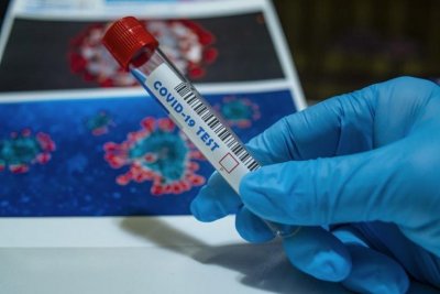10 нови болни от коронавирус, още двама починаха