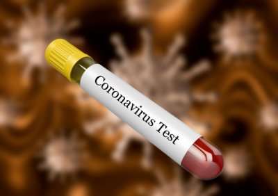 Над 343 000 починали от коронавируса по света
