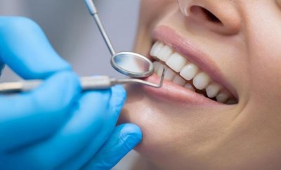 Обвиниха петима зъболекари за далавери