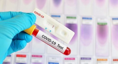 Контактните лица на болния лекар от Кюстендил нямат COVID-19