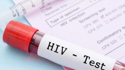 Чудо! Жена победи ХИВ без медицинска намеса