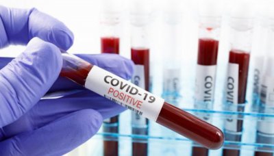Вирусолог: Няма данни за повторно заразяване с COVID-19 у нас