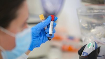 Заразените варненци са между 25 и 64-годишни