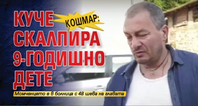 Кошмар: Куче скалпира 9-годишно дете