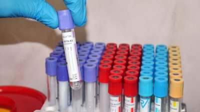 Доставиха бързи тестове за училища и детски градини в Бургас