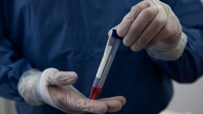 Коронавирусът мори свищовско село: 82% заразени дементноболни