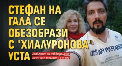 Стефан на Гала се обезобрази с "хиалуронова" уста