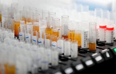 Великобритания регистрира най-малкия брой новозаразени с коронавирус