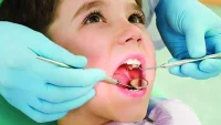 ШОК: Над 70% от децата до 7 години имат кариес